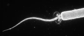 What is flagella